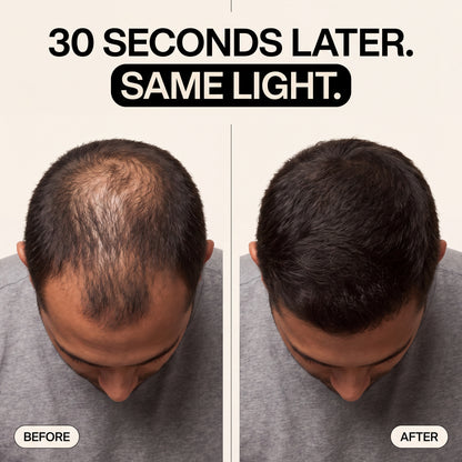 most. hair fibers