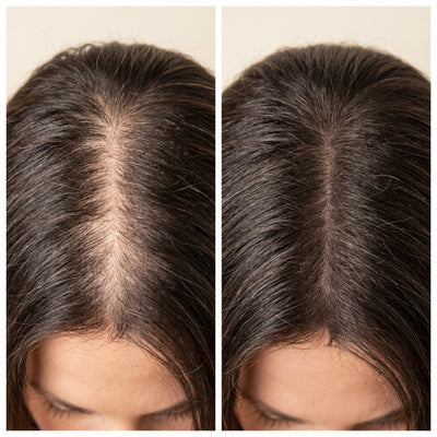 Before and after results of most. keratin hair building fibers on thinning crown area - woman hair transformation
